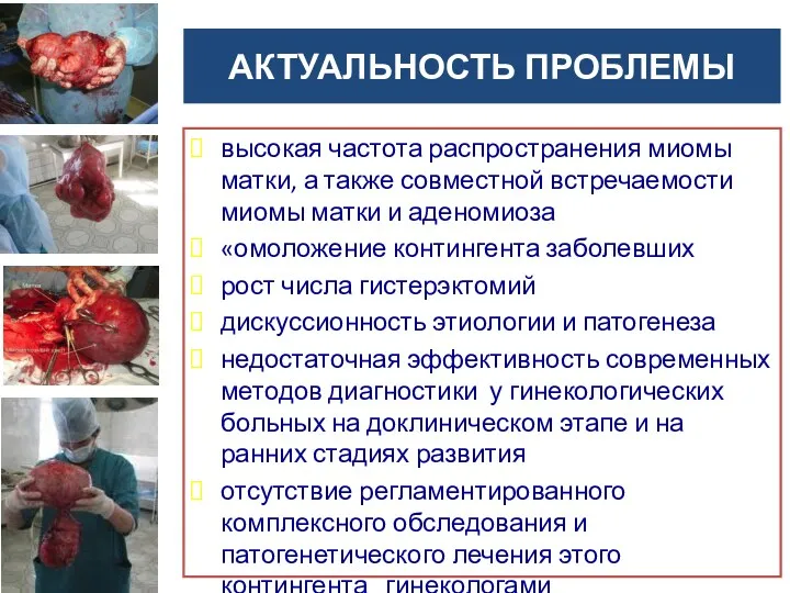 АКТУАЛЬНОСТЬ ПРОБЛЕМЫ высокая частота распространения миомы матки, а также совместной