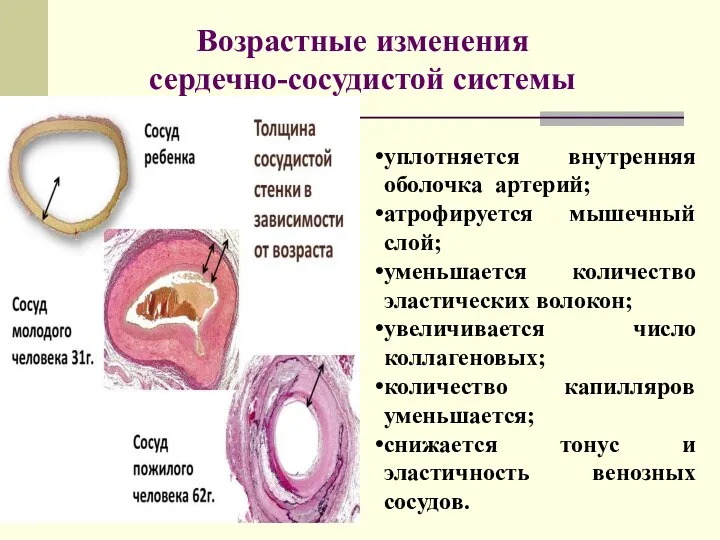 уплотняется внутренняя оболочка артерий; атрофируется мышечный слой; уменьшается количество эластических