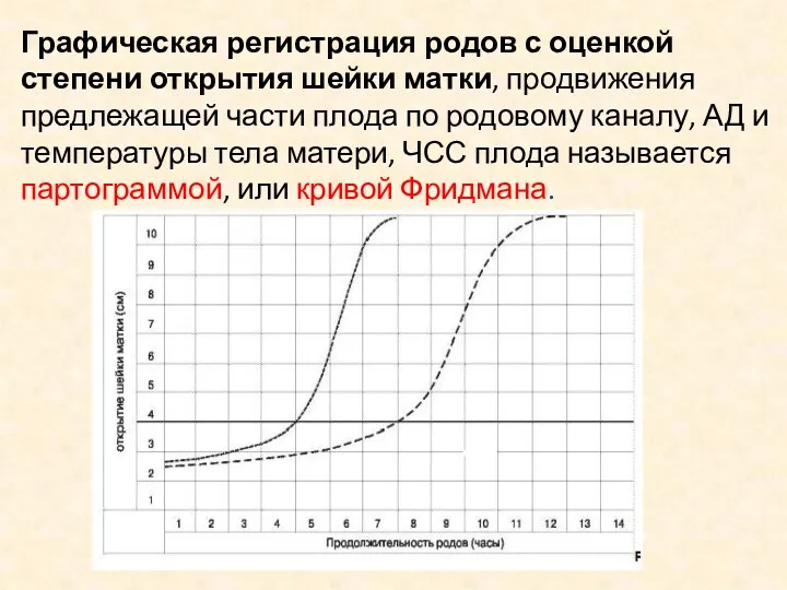 Графическая регистрация родов с оценкой степени открытия шейки матки, продвижения