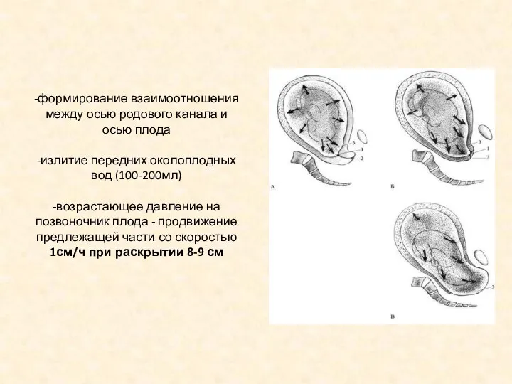 -формирование взаимоотношения между осью родового канала и осью плода -излитие