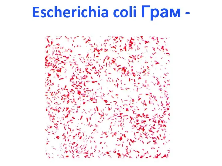 Escherichia coli Грам -