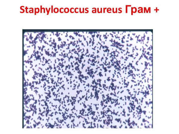 Staphylococcus aureus Грам +