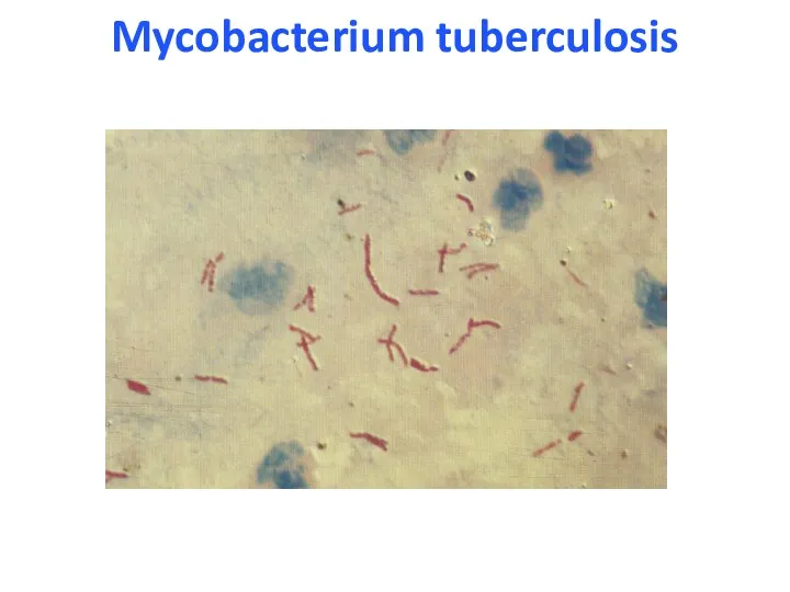 Mycobacterium tuberculosis