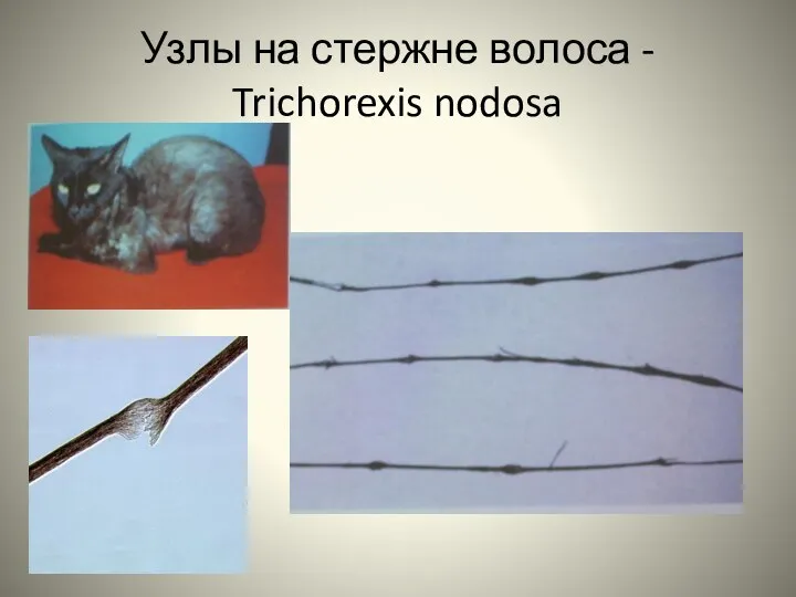 Узлы на стержне волоса - Trichorexis nodosa