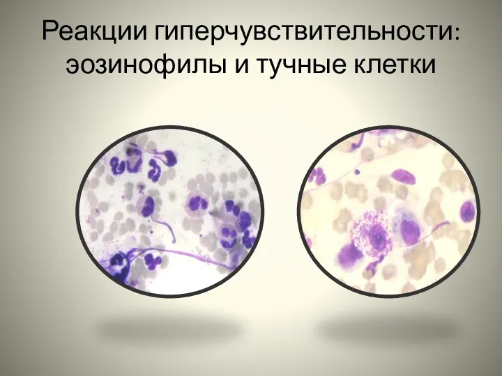 Реакции гиперчувствительности: эозинофилы и тучные клетки