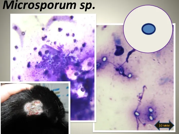 Microsporum sp. 10 мкм