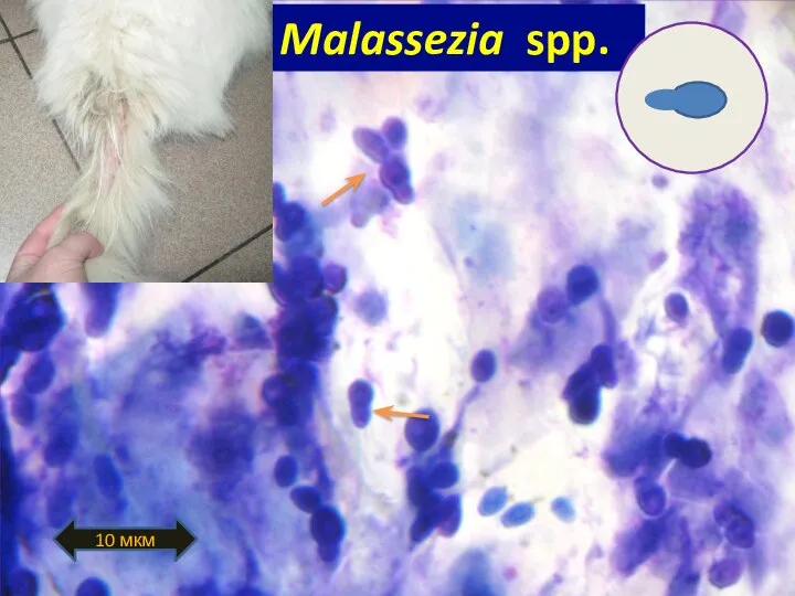 Malassez Malassezia spp. 10 мкм