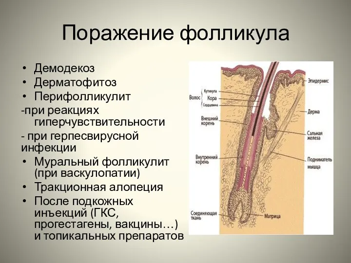 Поражение фолликула Демодекоз Дерматофитоз Перифолликулит -при реакциях гиперчувствительности - при герпесвирусной инфекции Муральный