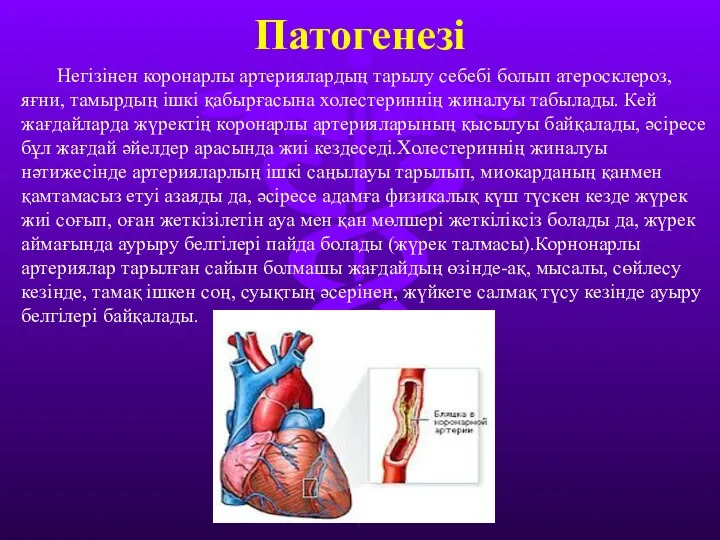 Патогенезі Негізінен коронарлы артериялардың тарылу себебі болып атеросклероз, яғни, тамырдың