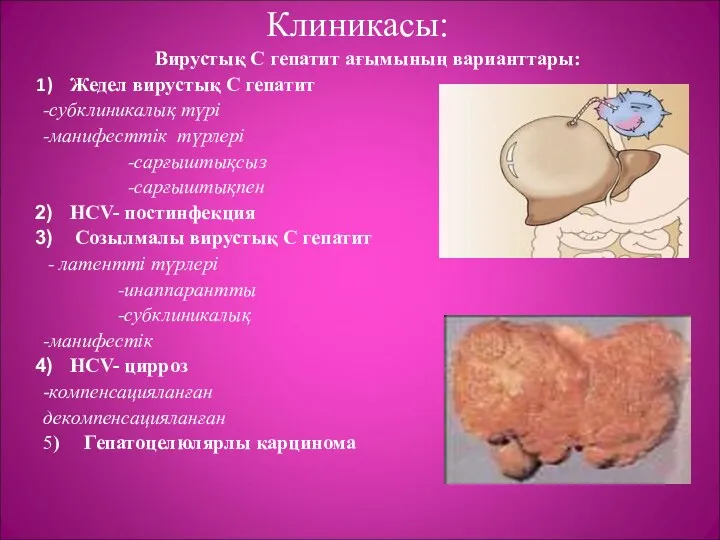 Клиникасы: Вирустық С гепатит ағымының варианттары: Жедел вирустық С гепатит