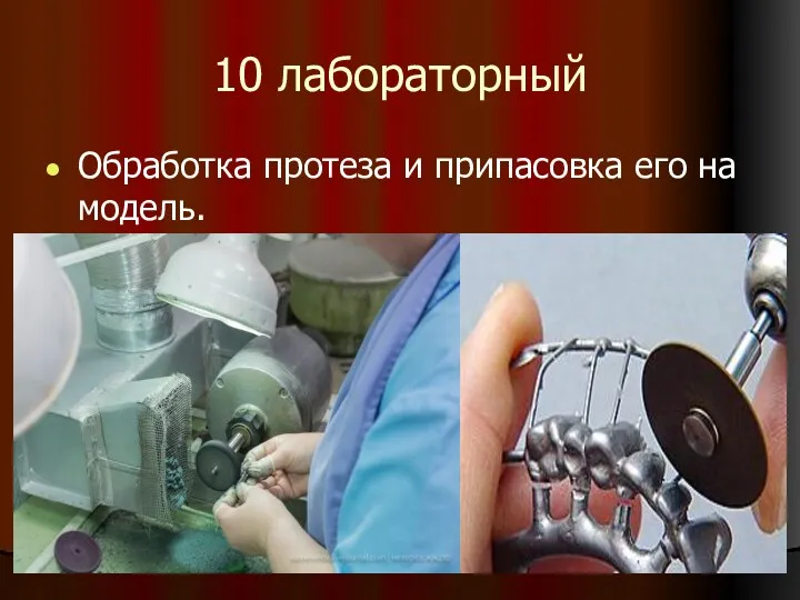 10 лабораторный Обработка протеза и припасовка его на модель.