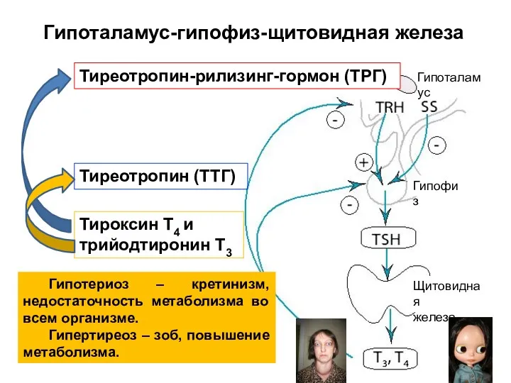 Гипотериоз – кретинизм, недостаточность метаболизма во всем организме. Гипертиреоз – зоб, повышение метаболизма.