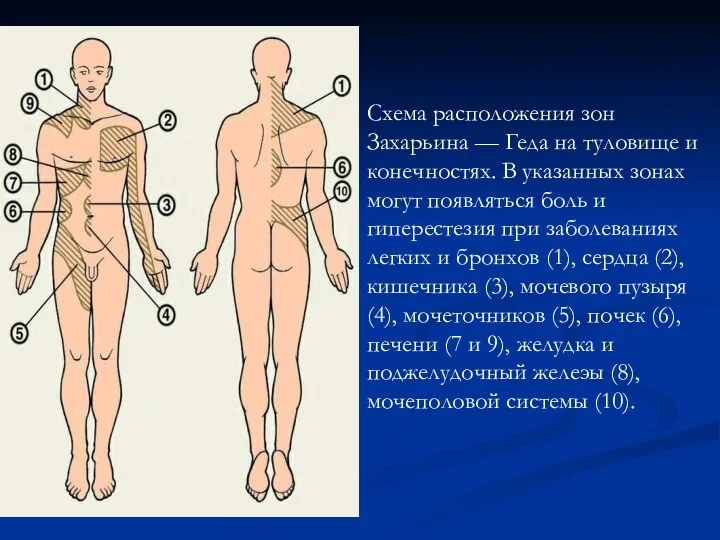 Схема расположения зон Захарьина — Геда на туловище и конечностях.