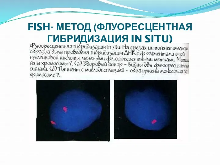 FISH- МЕТОД (ФЛУОРЕСЦЕНТНАЯ ГИБРИДИЗАЦИЯ IN SITU)