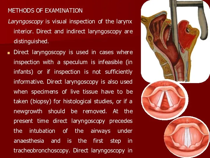 METHODS OF EXAMINATION Laryngoscopy is visual inspection of the larynx
