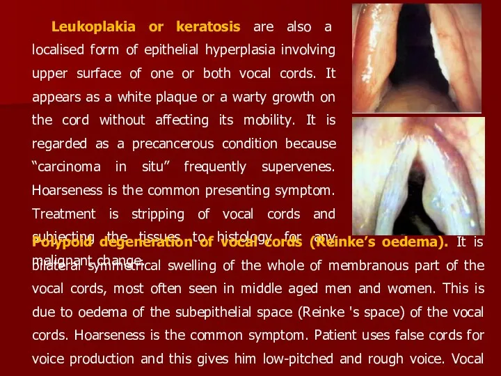 Leukoplakia or keratosis are also a localised form of epithelial