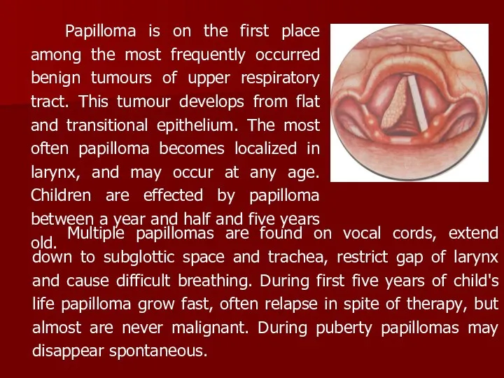 Papilloma is on the first place among the most frequently