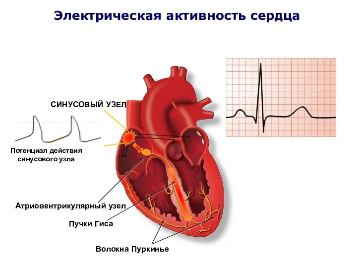 Электрическая активность сердца СИНУСОВЫЙ УЗЕЛ Комплекс QRS Атриовентрикулярный узел Пучки Гиса Волокна Пуркинье