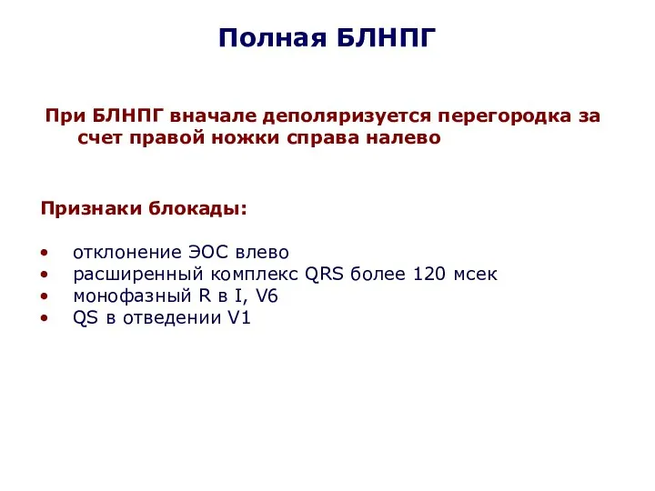 Полная БЛНПГ Признаки блокады: отклонение ЭОС влево расширенный комплекс QRS