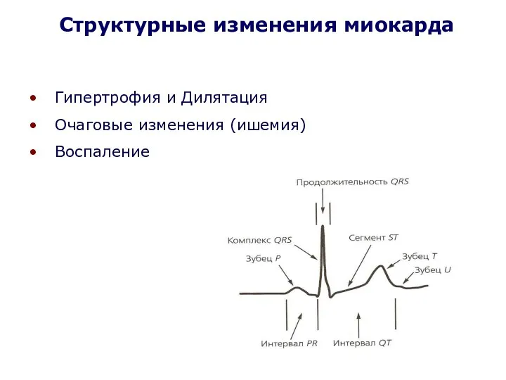 Гипертрофия и Дилятация Очаговые изменения (ишемия) Воспаление Структурные изменения миокарда