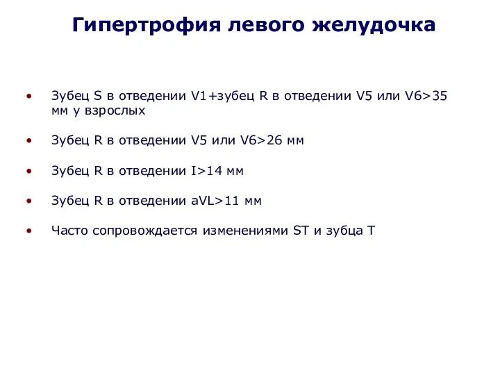 Зубец S в отведении V1+зубец R в отведении V5 или