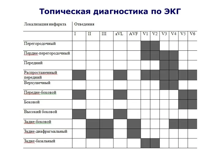 Топическая диагностика по ЭКГ