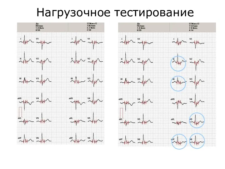 Нагрузочное тестирование