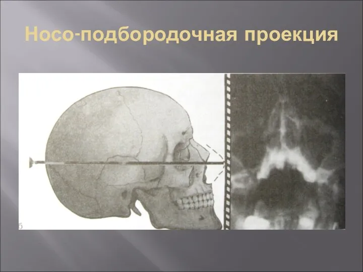 Носо-подбородочная проекция