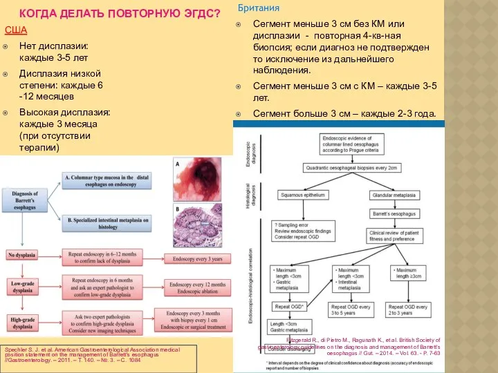 КОГДА ДЕЛАТЬ ПОВТОРНУЮ ЭГДС? США Нет дисплазии: каждые 3-5 лет Дисплазия низкой степени: