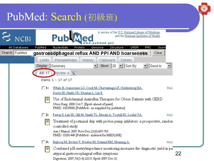 PubMed: Search (初級班) gastroesophageal reflux AND PPI AND hoarseness