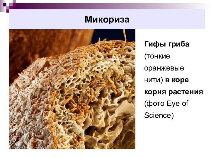 Микориза Гифы гриба (тонкие оранжевые нити) в коре корня растения (фото Eye of Science)