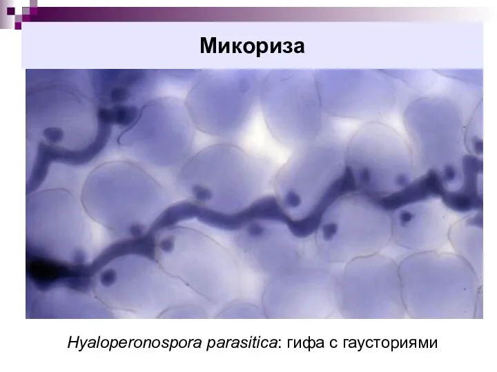 Микориза Hyaloperonospora parasitica: гифа с гаусториями
