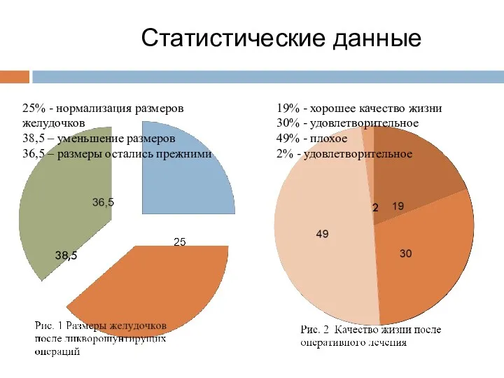 38,5 25% - нормализация размеров желудочков 38,5 – уменьшение размеров