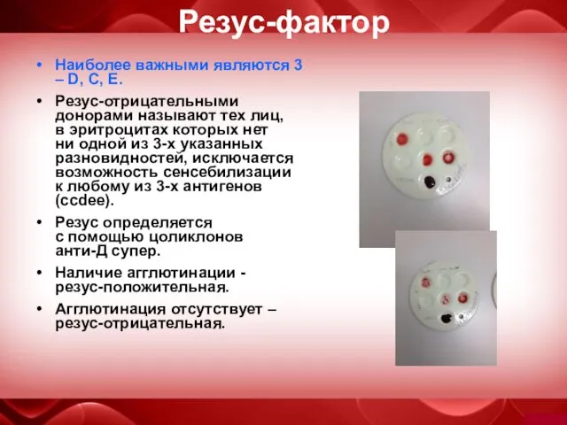 Резус-фактор Наиболее важными являются 3 – D, C, E. Резус-отрицательными