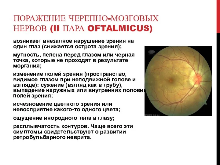 ПОРАЖЕНИЕ ЧЕРЕПНО-МОЗГОВЫХ НЕРВОВ (II ПАРА OFTALMICUS) возникает внезапное нарушение зрения