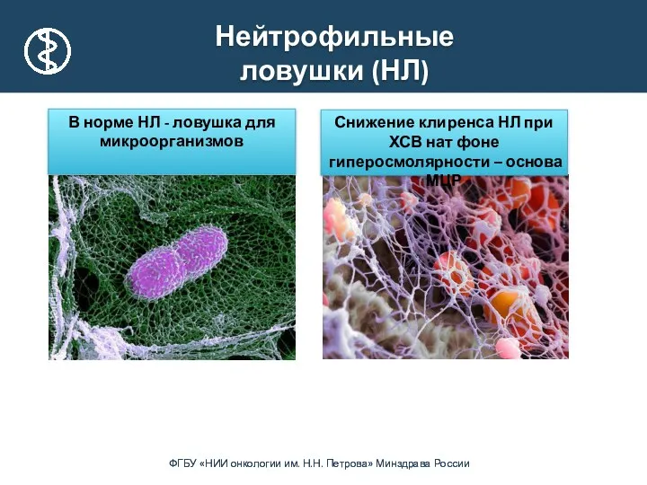 Нейтрофильные ловушки (НЛ) В норме НЛ - ловушка для микроорганизмов