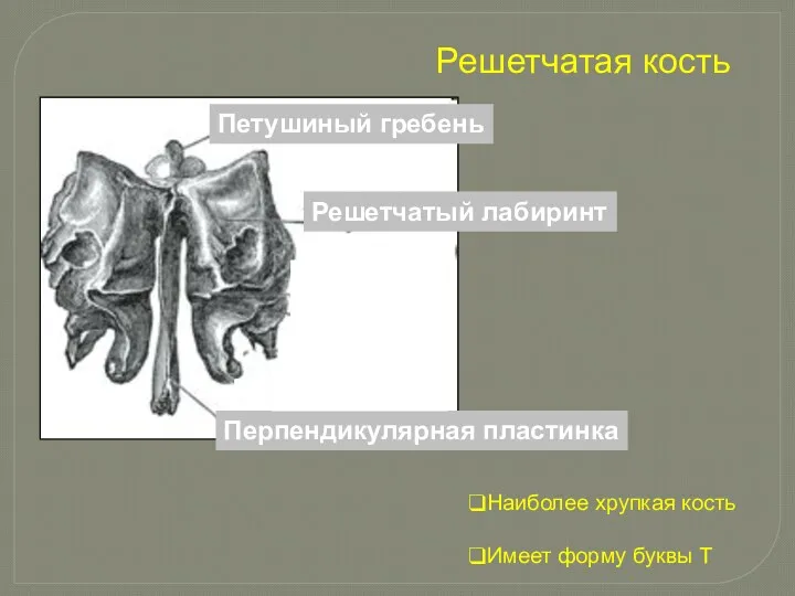 Решетчатая кость Петушиный гребень Наиболее хрупкая кость Имеет форму буквы Т Решетчатый лабиринт Перпендикулярная пластинка