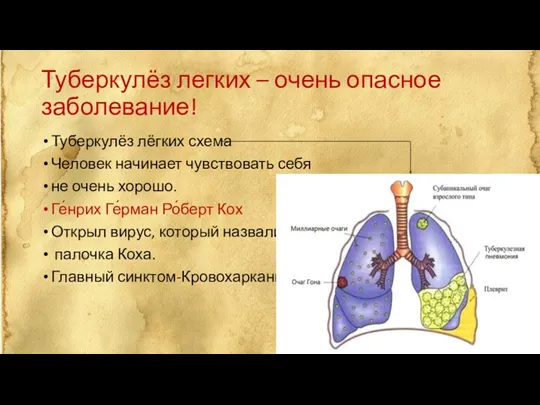 Туберкулёз легких – очень опасное заболевание! Туберкулёз лёгких схема Человек