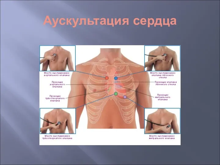 Аускультация сердца