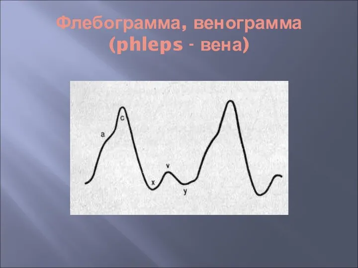 Флебограмма, венограмма (phleps - вена)