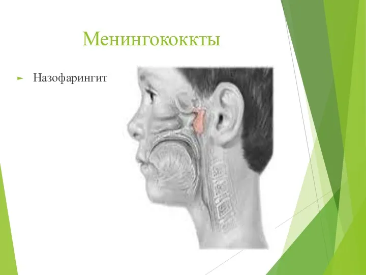 Менингококкты Назофарингит