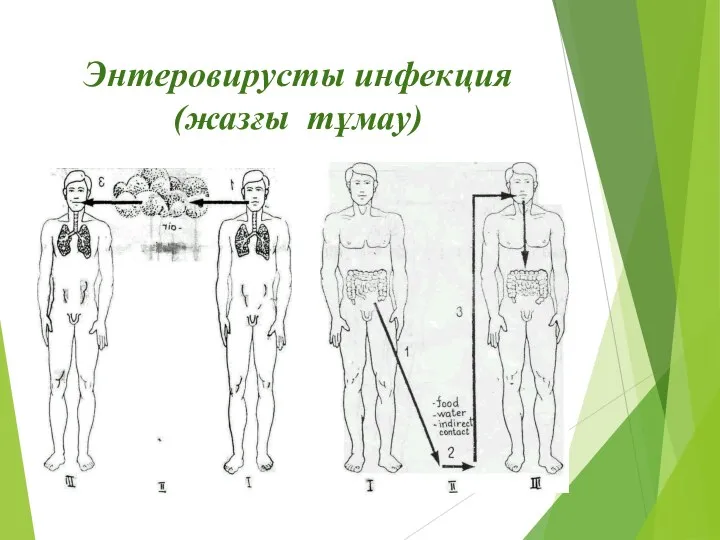 Энтеровирусты инфекция (жазғы тұмау)