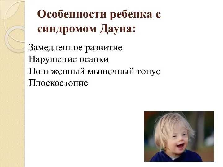 Особенности ребенка с синдромом Дауна: Замедленное развитие Нарушение осанки Пониженный мышечный тонус Плоскостопие