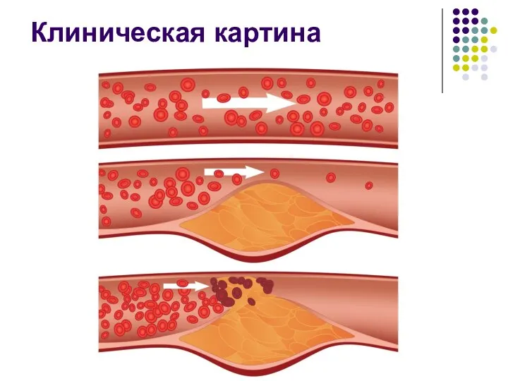 Клиническая картина