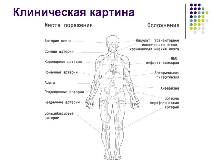 Клиническая картина