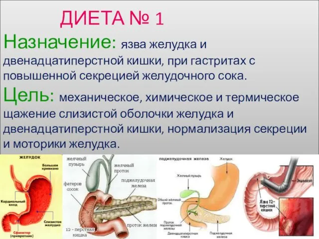 ДИЕТА № 1 Назначение: язва желудка и двенадцатиперстной кишки, при