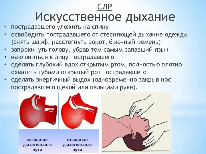 Искусственное дыхание СЛР пострадавшего уложить на спину освободить пострадавшего от