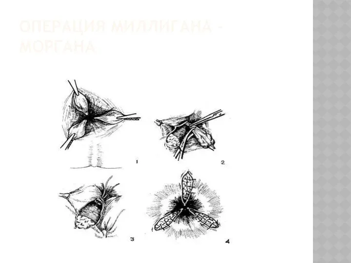 ОПЕРАЦИЯ МИЛЛИГАНА – МОРГАНА