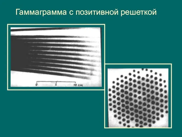 Гаммаграмма с позитивной решеткой