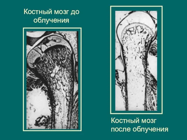 Костный мозг до облучения Костный мозг после облучения